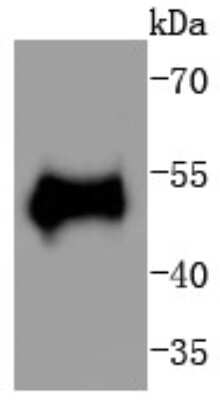 Western Blot: p53 [p Thr55] Antibody (SC58-01) [NBP2-67493] - Analysis of Phospho-p53(T55) on human skin lysates using anti-Phospho-p53(T55) antibody at 1/1,000 dilution.