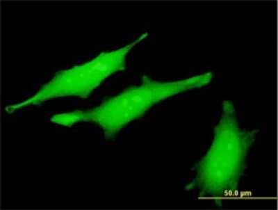 Immunocytochemistry/Immunofluorescence: p53R2 Antibody (6C1) [H00050484-M01] - Analysis of monoclonal antibody to RRM2B on HeLa cell . Antibody concentration 10 ug/ml.