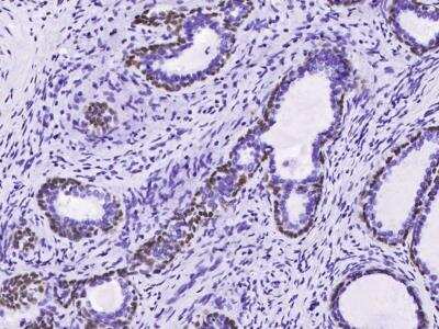 Immunohistochemistry-Paraffin: p63/TP73L Antibody (143) [NBP2-89212] - Staining of human P63 in human prostate with rabbit monoclonal antibody (1:200).