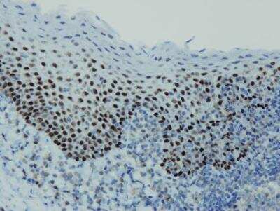 Immunohistochemistry-Paraffin: p63/TP73L Antibody (I27-I) [NBP3-08205] - Nuclear expression of p63/TP73L visualized with p63/TP73L antibody, clone I27-I, in squamous epithelium of the tonsil. Formalin fixed, paraffin embedded human tissues (4 um sections) stained with p63/TP73L monospecific clonal antibody.