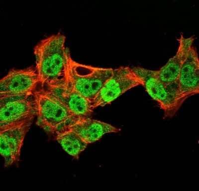 Immunocytochemistry/Immunofluorescence: p63/TP73L Antibody (TP40/3980R) - Azide and BSA Free [NBP3-08775] - Immunofluorescence Analysis of PFA-fixed HeLa cells labeling p63/TP73L Recombinant Rabbit Monoclonal Antibody (TP40/3980R) followed by goat anti-rabbit IgG-CF488 (Green). Membrane stained with phalloidin (red).