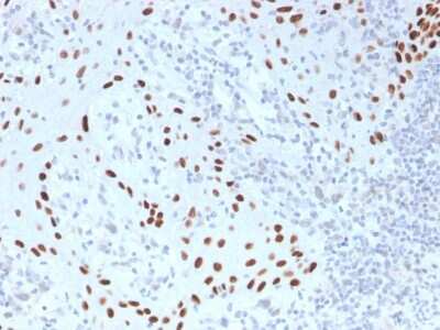 Immunohistochemistry-Paraffin: p63/TP73L Antibody (TP40/3980R) - Azide and BSA Free [NBP3-08775] - Formalin-fixed, paraffin-embedded human skin stained with p63/TP73L Recombinant Rabbit Monoclonal Antibody (TP40/3980R).