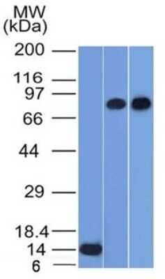 Western Blot: p63/TP73L Antibody (TP63/1786) [NBP3-08734] - Western Blot of Recombinant, PC3 and HeLa cell lysates using p63/TP73L Mouse Monoclonal Antibody (TP63/1786).
