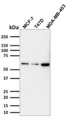 Western Blot: p63/TP73L Antibody (TP63/1786) [NBP3-08734] - Western Blot Analysis MCF-7; T47D and MDA-MB453 cell lysate using p63/TP73L Mouse Monoclonal Antibody (TP63/1786).