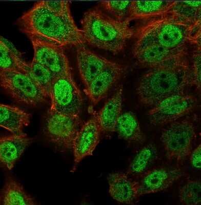 Immunocytochemistry/Immunofluorescence: p63/TP73L Antibody (ZR8) - Azide and BSA Free [NBP3-08776] - Immunofluorescence Analysis of PFA-fixed HeLa cells labeling p63/TP73L Recombinant Rabbit Monoclonal Antibody (ZR8) followed by goat anti-rabbit IgG-CF488 (green); phalloidin counterstain (red).