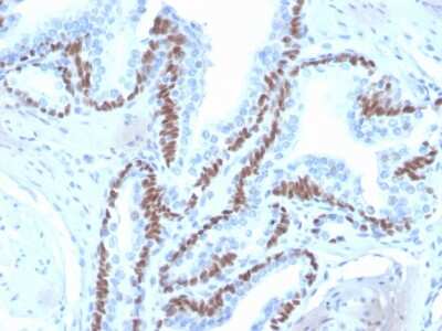 Immunohistochemistry-Paraffin: p63/TP73L Antibody (ZR8) - Azide and BSA Free [NBP3-08776] - Formalin-fixed, paraffin-embedded human skin stained with p63/TP73L Recombinant Rabbit Monoclonal Antibody (ZR8).