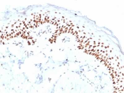 Immunohistochemistry-Paraffin: p63/TP73L Antibody (ZR8) - Azide and BSA Free [NBP3-08776] - Formalin-fixed, paraffin-embedded human skin stained with p63/TP73L Recombinant Rabbit Monoclonal Antibody (ZR8).