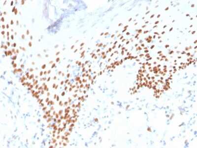 Immunohistochemistry-Paraffin: p63/TP73L Antibody (rTP40/3690) - Azide and BSA Free [NBP3-08660] - Formalin-fixed, paraffin-embedded human skin stained with p63/TP73L Recombinant Mouse Monoclonal Antibody (rTP40/3690).