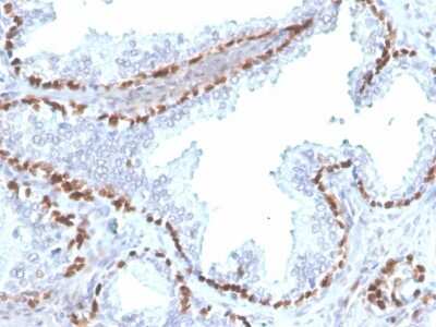 Immunohistochemistry-Paraffin: p63/TP73L Antibody (rTP40/3690) - Azide and BSA Free [NBP3-08660] - Formalin-fixed, paraffin-embedded human kidney stained with p63/TP73L Recombinant Mouse Monoclonal Antibody (rTP40/3690).