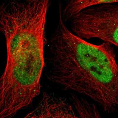 Immunocytochemistry/Immunofluorescence: p66 alpha Antibody [NBP1-87359] - Staining of human cell line U-2 OS shows localization to nucleoplasm. Antibody staining is shown in green.