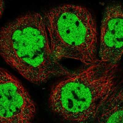 <b>Genetic Strategies Validation. </b>Immunocytochemistry/Immunofluorescence: p66 alpha Antibody [NBP1-87360] - Staining of human cell line A-431 shows localization to nucleoplasm. Antibody staining is shown in green.