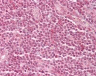 Immunohistochemistry-Paraffin: p66 alpha Antibody [NB100-56643] - analysis of human tonsil using p66 antibody at 1:50.