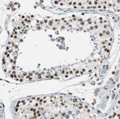 Immunohistochemistry-Paraffin: p66 alpha Antibody [NBP1-87359] - Staining of human testis shows strong nuclear positivity in cells in seminiferous ducts.