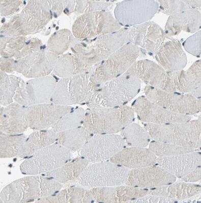 Immunohistochemistry-Paraffin: p66 alpha Antibody [NBP1-87359] - Staining of human skeletal muscle shows very weak positivity in myocytes as expected.
