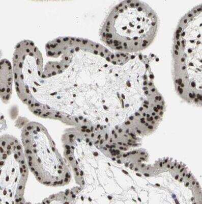 Immunohistochemistry-Paraffin: p66 alpha Antibody [NBP1-87359] - Staining of human placenta shows trong nuclear positivity in trophoblastic cells.