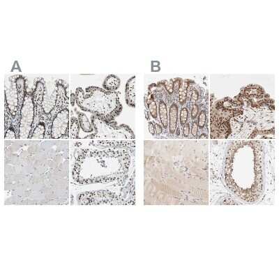 Immunohistochemistry-Paraffin: p66 alpha Antibody [NBP1-87359] - Staining of human colon, placenta, skeletal muscle and testis using Anti-p66 alpha antibody NBP1-87359 (A) shows similar protein distribution across tissues to independent antibody NBP1-87360 (B).