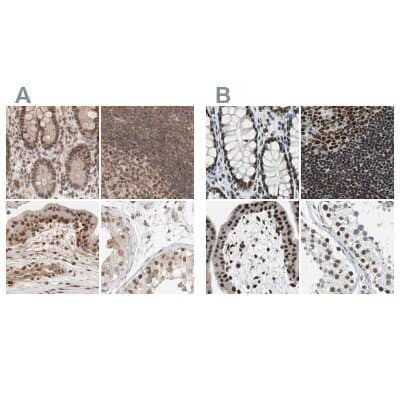 <b>Independent Antibodies Validation. </b>Immunohistochemistry-Paraffin: p66 alpha Antibody [NBP1-87360] - Staining of human colon, lymph node, placenta and testis using Anti-GATAD2A antibody NBP1-87360 (A) shows similar protein distribution across tissues to independent antibody NBP1-87359 (B).