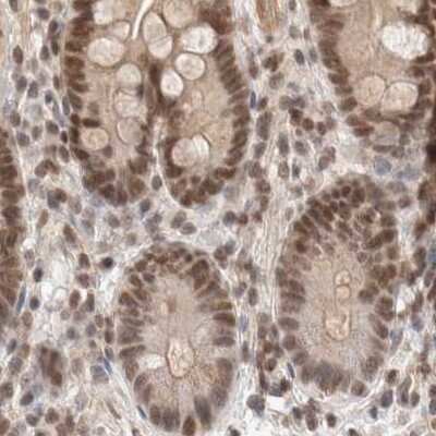 Immunohistochemistry-Paraffin: p66 alpha Antibody [NBP1-87360] - Staining of human colon.