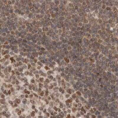Immunohistochemistry-Paraffin: p66 alpha Antibody [NBP1-87360] - Staining of human lymph node.