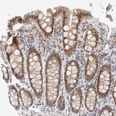 Immunohistochemistry-Paraffin: p66 alpha Antibody [NBP1-87360] - Staining of human colon shows strong nuclear positivity in glandular cells.