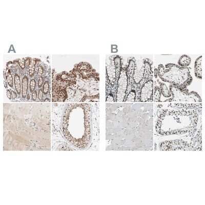 <b>Independent Antibodies Validation. </b>Immunohistochemistry-Paraffin: p66 alpha Antibody [NBP1-87360] - Staining of human colon, placenta, skeletal muscle and testis using Anti-p66 alpha antibody NBP1-87360 (A) shows similar protein distribution across tissues to independent antibody NBP1-87359 (B).