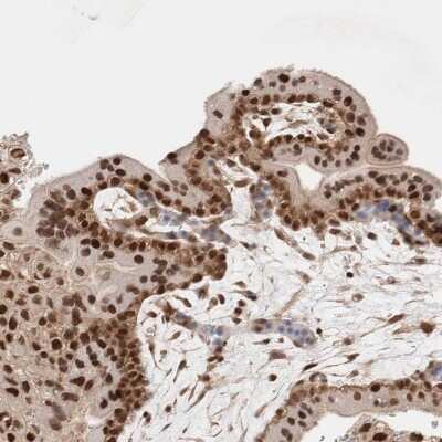 Immunohistochemistry-Paraffin: p66 alpha Antibody [NBP1-87360] - Staining of human placenta shows strong nuclear positivity in trophoblastic cells.