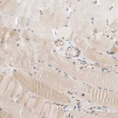 Immunohistochemistry-Paraffin: p66 alpha Antibody [NBP1-87360] - Staining of human skeletal muscle shows very weak positivity in myocytes as expected.
