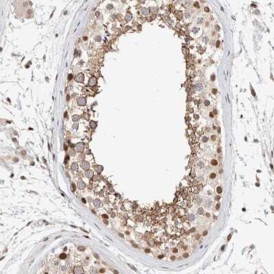 Immunohistochemistry-Paraffin: p66 alpha Antibody [NBP1-87360] - Staining of human testis shows moderate nuclear positivity in cells in seminiferous ducts.