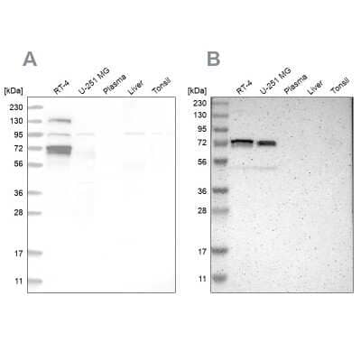 <b>Independent Antibodies Validation. </b>Western Blot: p66 alpha Antibody [NBP1-87360] - Analysis using Anti-GATAD2A antibody NBP1-87360 (A) shows similar pattern to independent antibody NBP1-87359 (B).