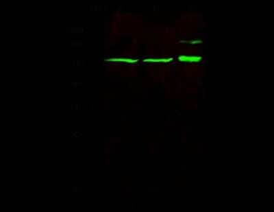 Western Blot: p66 alpha Antibody [NBP2-98801] - Anti-p66 alpha rabbit polyclonal antibody at 1:500 dilution. Lane A: Jurkat Whole Cell Lysate. Lane B: Hela Whole Cell Lysate. Lane C: 293T Whole Cell Lysate. Lysates/proteins at 30 ug per lane. Secondary Goat Anti-Rabbit IgG H&L (Dylight 800) at 1/10000 dilution. Developed using the Odyssey technique. Performed under reducing conditions. Predicted band size: 66 kDa. Observed band size: 55 kDa (We are unsure as to the identity of these extra bands).