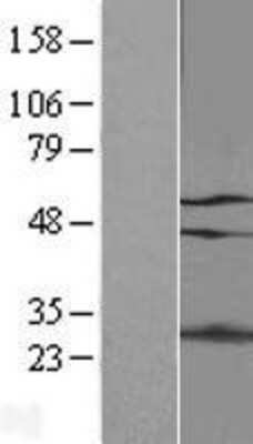 Western Blot p66 alpha Overexpression Lysate