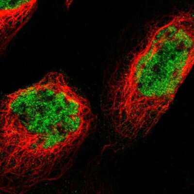 Immunocytochemistry/ Immunofluorescence p66 beta Antibody - BSA Free