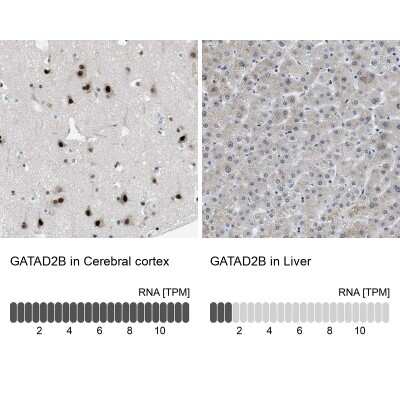 Immunohistochemistry-Paraffin p66 beta Antibody - BSA Free