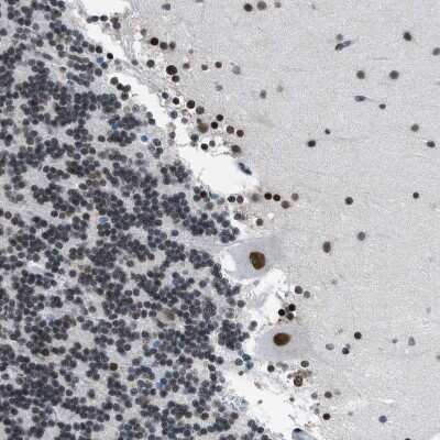 Immunohistochemistry-Paraffin: p66 beta Antibody [NBP1-87358] - Staining of human Cerebellum shows strong nuclear positivity in Purkinje cells.