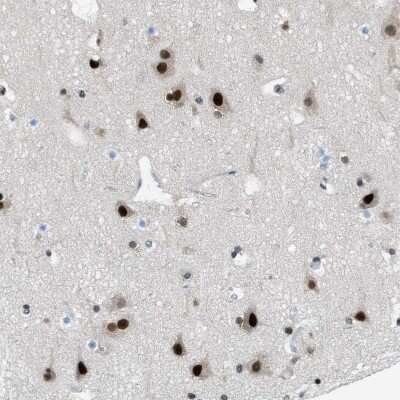 Immunohistochemistry-Paraffin: p66 beta Antibody [NBP1-87358] - Staining of human Cerebral cortex shows strong nuclear positivity in neuronal and glial cells.