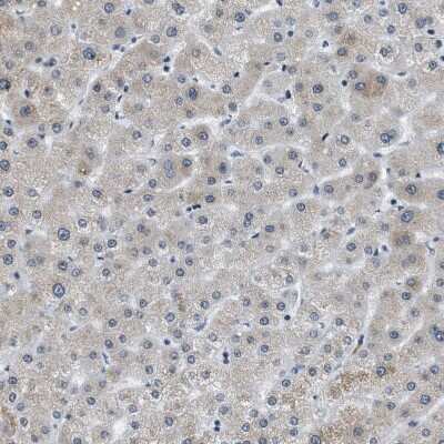 Immunohistochemistry-Paraffin: p66 beta Antibody [NBP1-87358] - Staining of human Liver shows very weak nuclear positivity in hepatocytes.