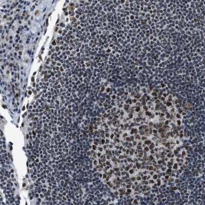 Immunohistochemistry-Paraffin: p66 beta Antibody [NBP1-87358] - Staining of human Lymph node shows strong nuclear positivity in germinal and non-germinal center cells.