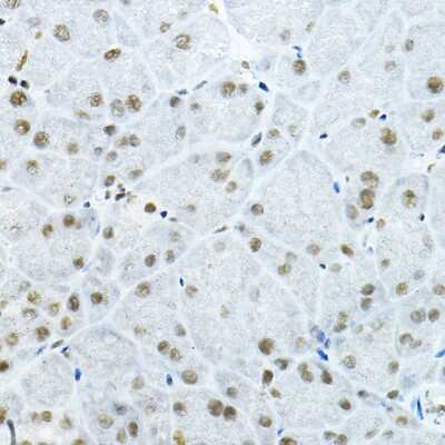 Immunohistochemistry-Paraffin: p66 beta Antibody [NBP2-93311] - Immunohistochemistry of paraffin-embedded mouse pancreas using p66 beta Rabbit pAb (NBP2-93311) at dilution of 1:100 (40x lens). Perform high pressure antigen retrieval with 10 mM citrate buffer pH 6.0 before commencing with IHC staining protocol.