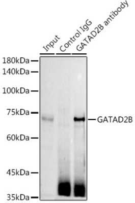 Immunoprecipitation: p66 beta Antibody [NBP2-93311] - Immunoprecipitation analysis of 300ug extracts of Jurkat cells using 3ug p66 beta antibody (NBP2-93311). Western blot was performed from the immunoprecipitate using p66 beta antibody (NBP2-93311) at a dilution of 1:1000.