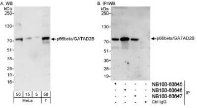 <b>Independent Antibodies Validation and Biological Strategies Validation.</b>Western Blot: p66 beta Antibody [NB100-60645] - Detection of Human p66beta/GATAD2B on HeLa whole cell lysate using NB100-60645. p66beta/GATAD2B was also immunoprecipitated by rabbit anti-p66beta/GATAD2B antibodies NB100-60646 and NB100-60647.