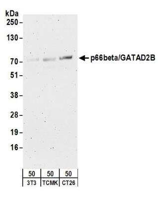 Western Blot: p66 beta Antibody [NB100-60645] - Detection of Mouse p66beta/GATAD2B by Western Blot. Samples: Whole cell lysate (50 ug) from NIH3T3, TCMK-1, and CT26.WT cells. Antibodies: Affinity purified rabbit anti-p66beta/GATAD2B antibody NB100-60645 used for WB at 0.5 ug/ml. Detection: Chemiluminescence with an exposure time of 3 minutes.