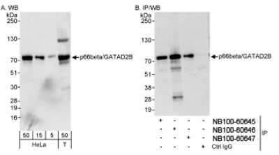 Western Blot p66 beta Antibody