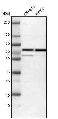 Western Blot: p66 beta Antibody [NBP1-87358] - Analysis in mouse cell line NIH-3T3 and rat cell line NBT-II.