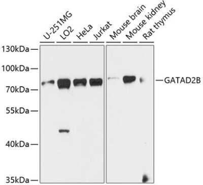 Western Blot: p66 beta Antibody [NBP2-93311] - Analysis of extracts of various cell lines, using p66 beta at 1:1000 dilution.Secondary antibody: HRP Goat Anti-Rabbit IgG (H+L) at 1:10000 dilution.Lysates/proteins: 25ug per lane.Blocking buffer: 3% nonfat dry milk in TBST.Detection: ECL Basic Kit .Exposure time: 60s.