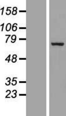 Western Blot: p66 beta Overexpression Lysate (Adult Normal) [NBL1-10987] Left-Empty vector transfected control cell lysate (HEK293 cell lysate); Right -Over-expression Lysate for p66 beta.