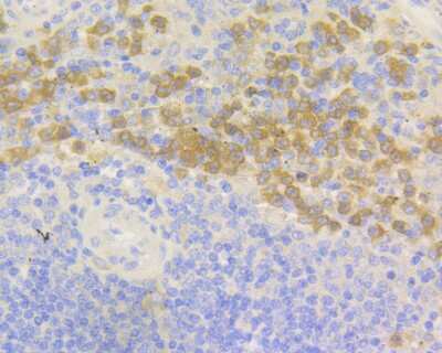 Immunohistochemistry-Paraffin: p67phox/NOXA2 Antibody (JG86-31) [NBP2-75605] - Analysis of paraffin-embedded human spleen tissue using anti-NOXA2 antibody. Counter stained with hematoxylin.