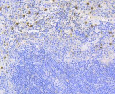 Immunohistochemistry-Paraffin: p67phox/NOXA2 Antibody (JG86-31) [NBP2-75605] - Analysis of paraffin-embedded mouse spleen tissue using anti-NOXA2 antibody. Counter stained with hematoxylin.