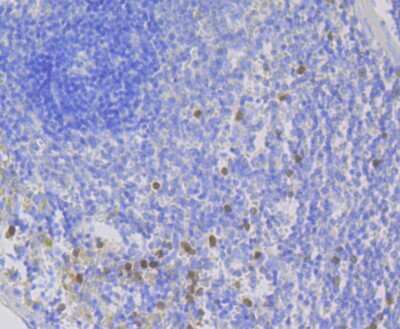 Immunohistochemistry-Paraffin: p67phox/NOXA2 Antibody (JG86-31) [NBP2-75605] - Analysis of paraffin-embedded rat spleen tissue using anti-NOXA2 antibody. Counter stained with hematoxylin.