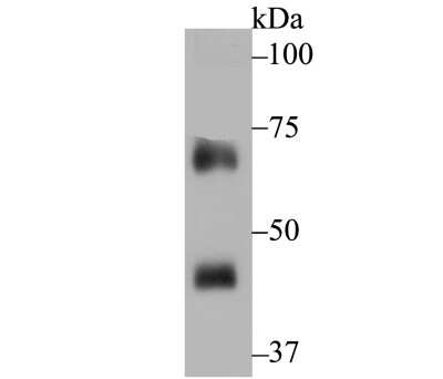 Western Blot: p67phox/NOXA2 Antibody (JG86-31) [NBP2-75605] - Analysis of NOXA2 on rat spleen tissue lysate using anti-NOXA2 antibody at 1/500 dilution.