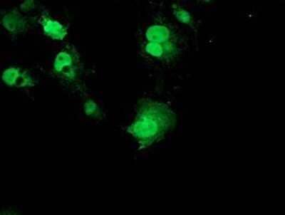 Immunocytochemistry/Immunofluorescence: p70 S6 Kinase/S6K Antibody (OTI1G4) - Azide and BSA Free [NBP2-73209] - Staining of COS7 cells transiently transfected by pCMV6-ENTRY S6K.